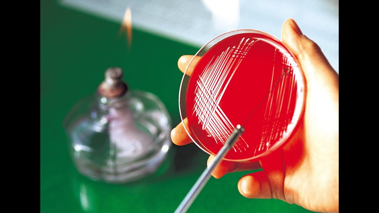 Técnicas de semeadura utilizadas em microbiologia de alimentos