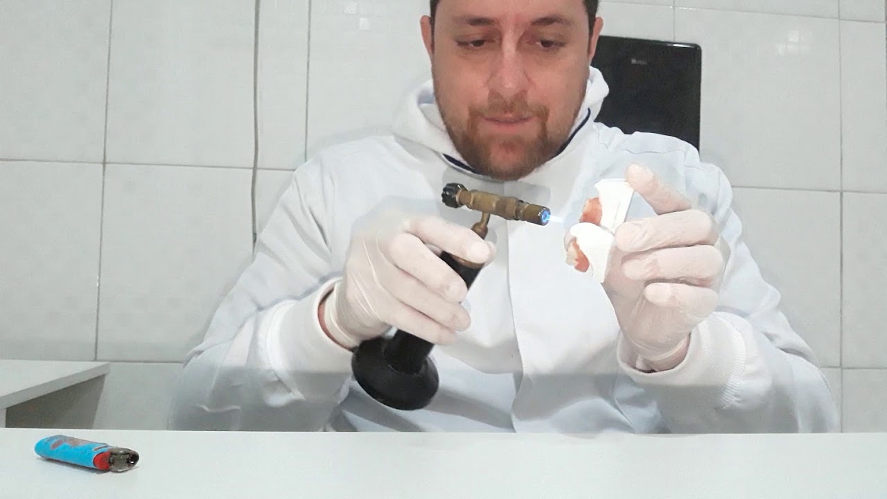 Polimento de Prótese flexível