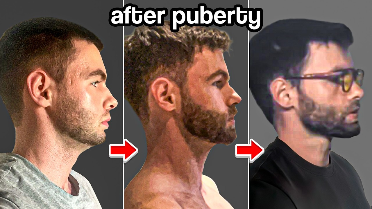 How I Transformed This 28 Year Old's Jaw Naturally