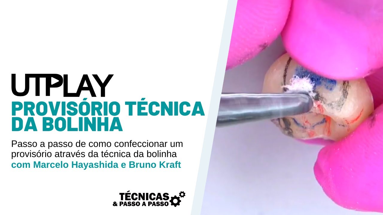 UTPLAY - Provisório Técnica da Bolinha -Dr. Marcelo Hayashida e Dr. Bruno Kraft