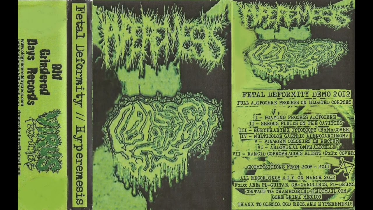 Fetal deformity - split with hyperemesis [FULLALBUM 2012]
