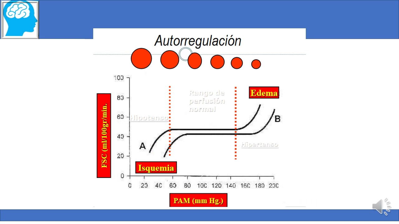 2  Manejo de Hipertensión en ACV isquemico agudo