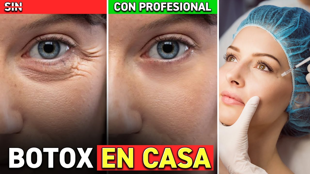 ¡Haz BOTOX EN CASA! ¡Rápido y Económico! ¡Rejuvenece tu rostro!
