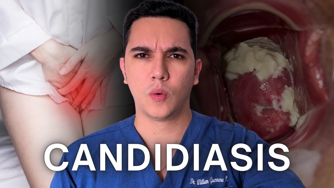 Candidiasis, flujo como leche cortada | Dr. William Guerrero