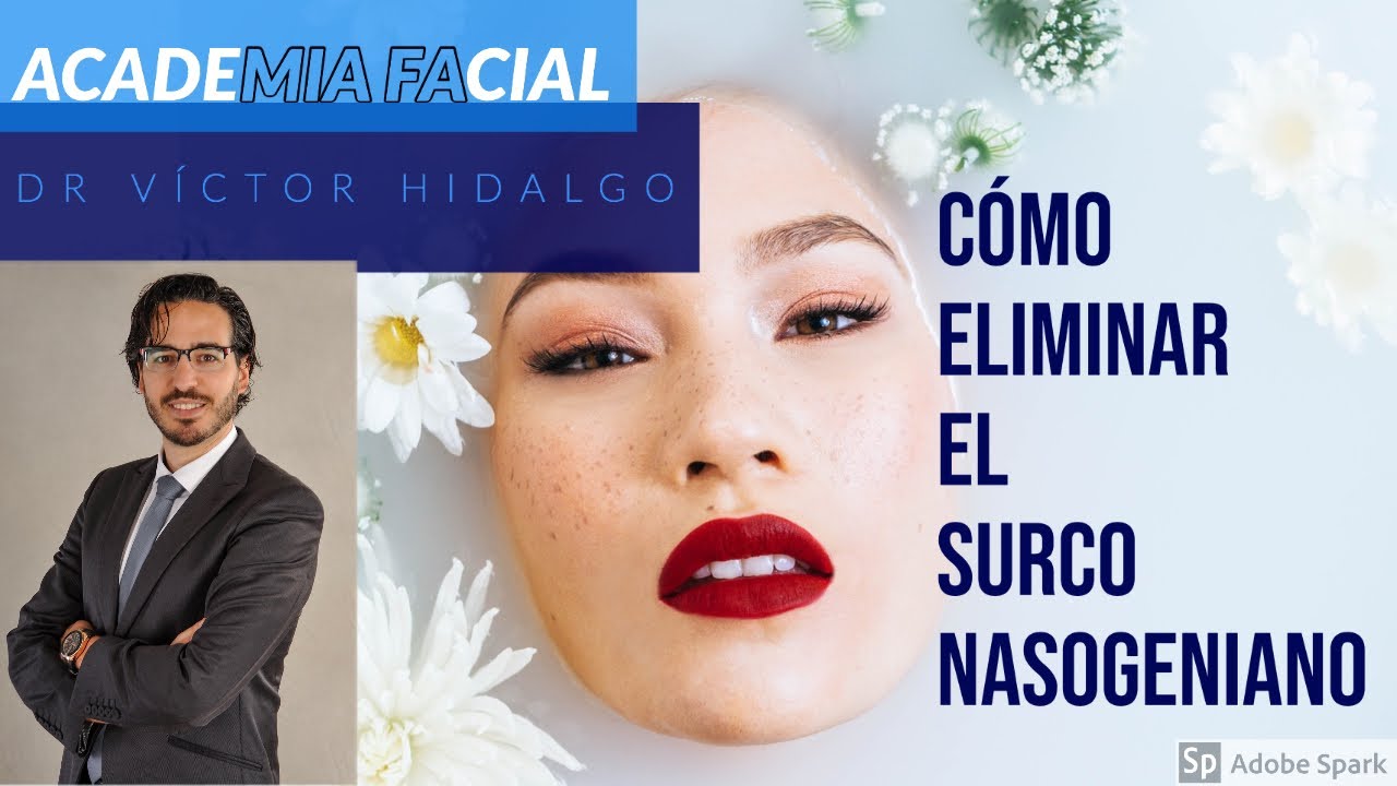ELIMINAR SURCO NASOGENIANO POR DR HIDALGO