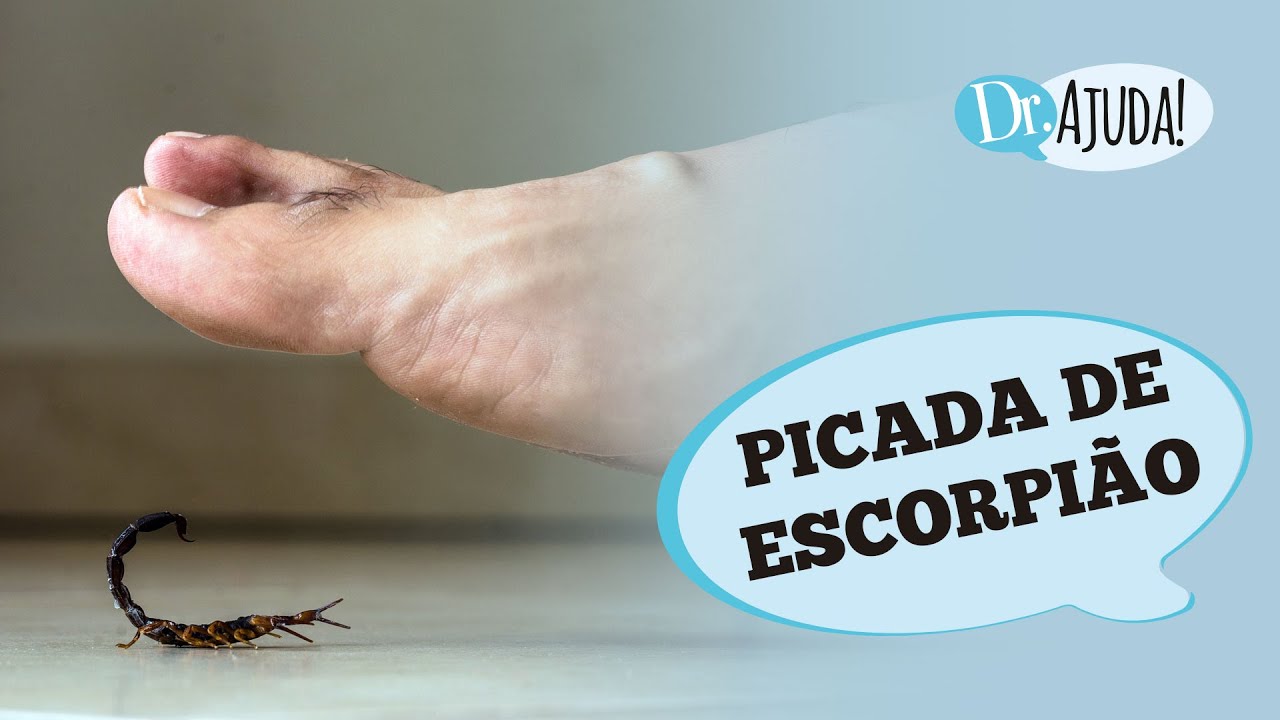 PICADA DE ESCORPIÃO: O QUE ACONTECE? SINTOMAS, O QUE FAZER E COMO PREVENIR?
