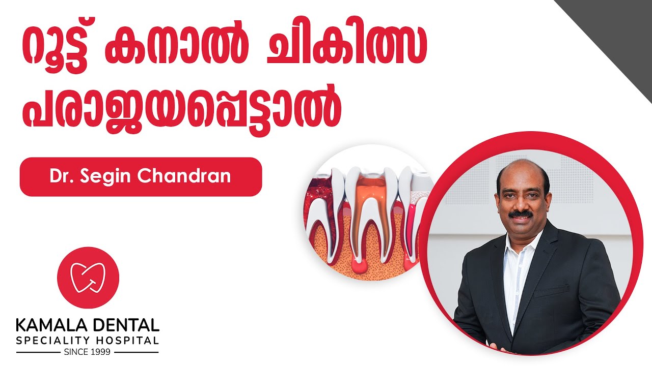 റൂട്ട് കനാൽ ചികിത്സ പരാജയപ്പെട്ടാൽ| Root Canal Treatment failure| Dr.Segin Chandran
