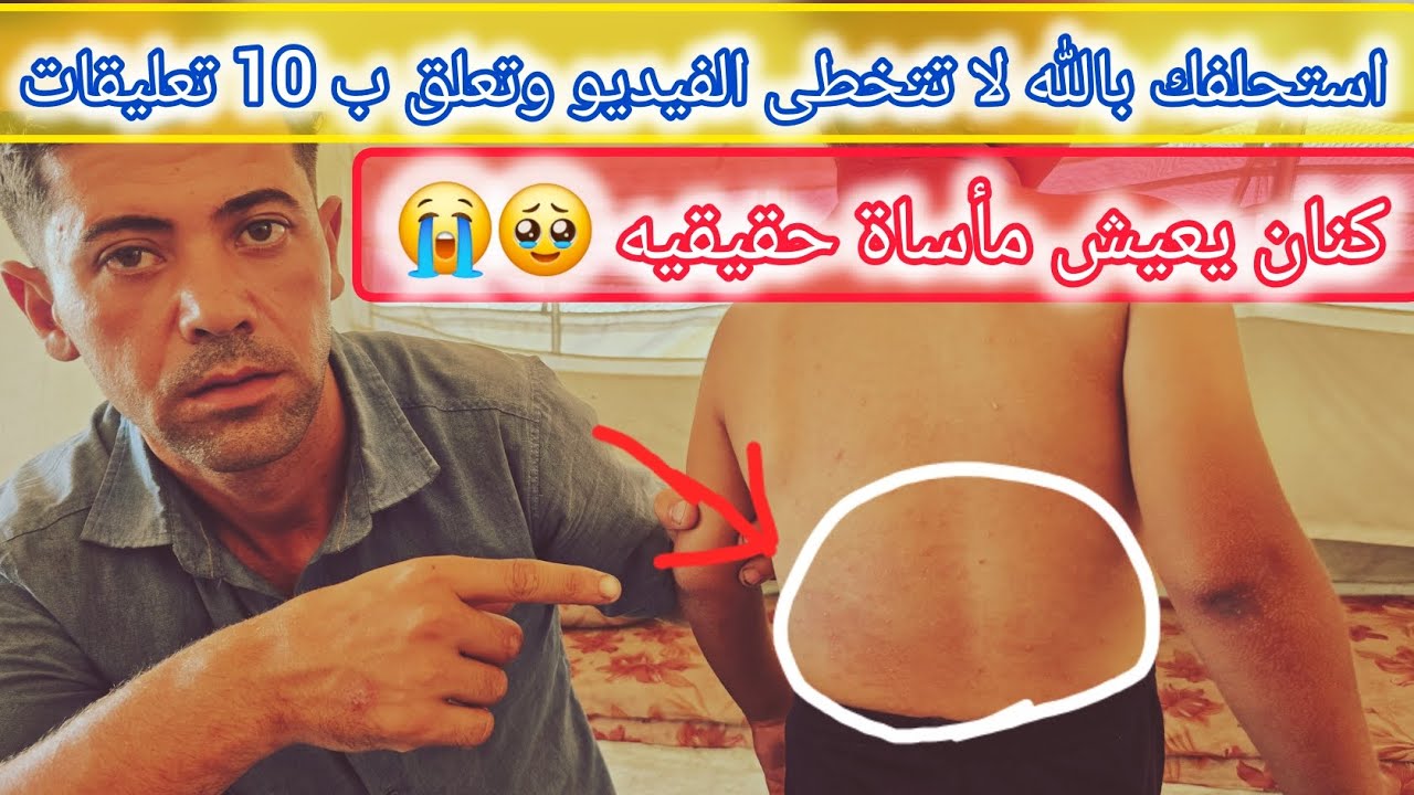 الخيمة وكنان مأساة 😭استحلفك بالله تعلق ب 10 تعليقات ❤️‍🩹🤲⁉️