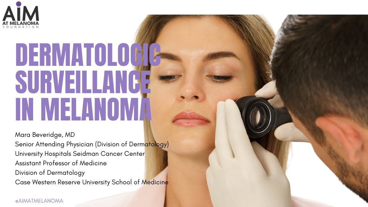 Dermatologic Surveillance in Melanoma