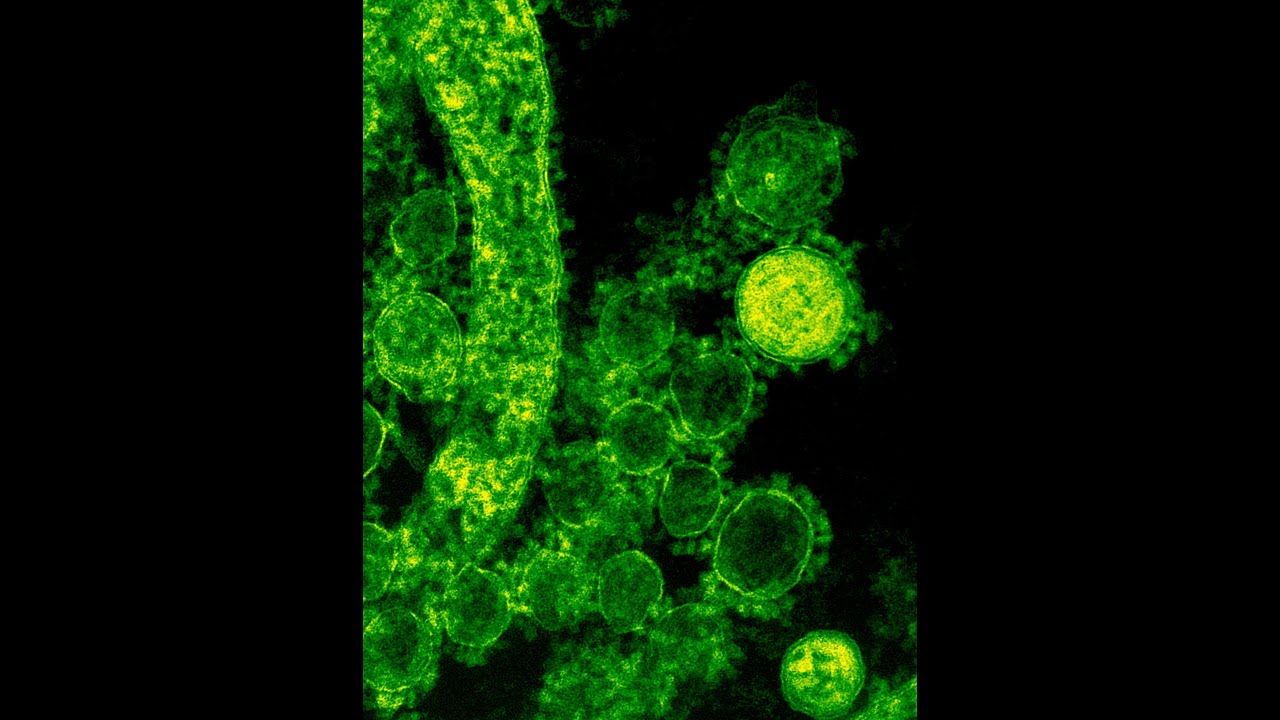 (FREE) DARK TYPE BEAT 130 BPM-TOXİC