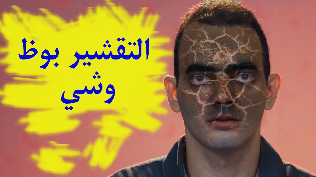 مشاكل تقشير البشرة