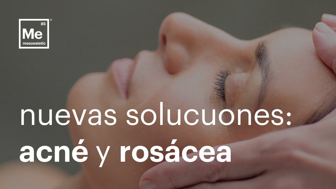 NUEVAS SOLUCIONES tópicas para el ACNÉ y la ROSÁCEA | mesoestetic®