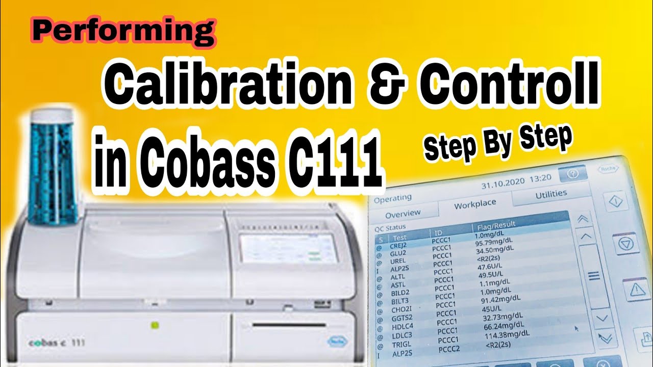 Control and Calibration Performing in Cobas C 111 Step by Step Biochemistry Analyser