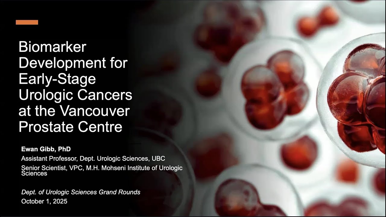 Biomarker Development for Early-Stage Urologic Cancers at the Vancouver Prostate Centre