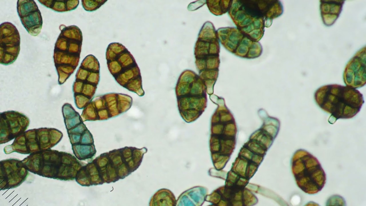 Airborne fungal spores Identification
