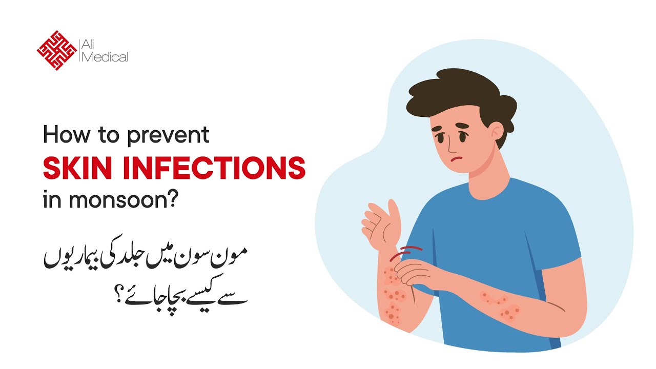 How to prevent Skin Infections in Monsoon Season | Dermatologist Advice | Skin Care 101