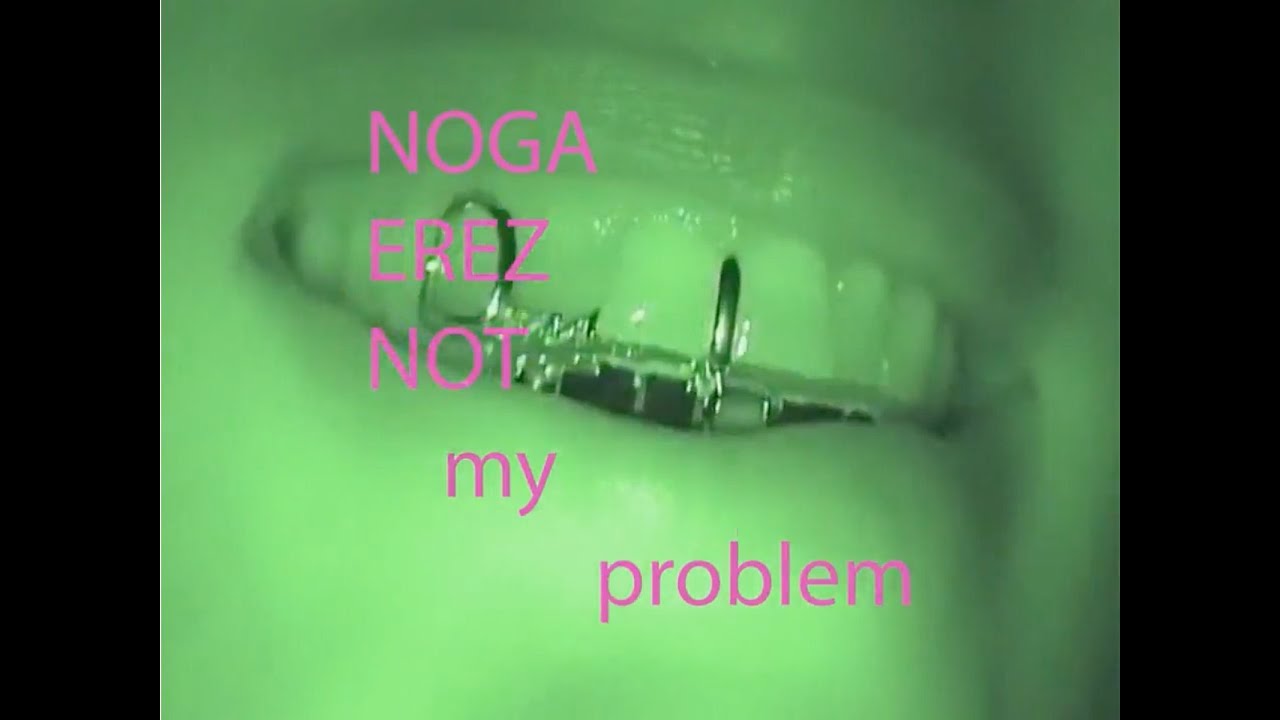Noga Erez - NOT MY PROBLEM (Official Video)