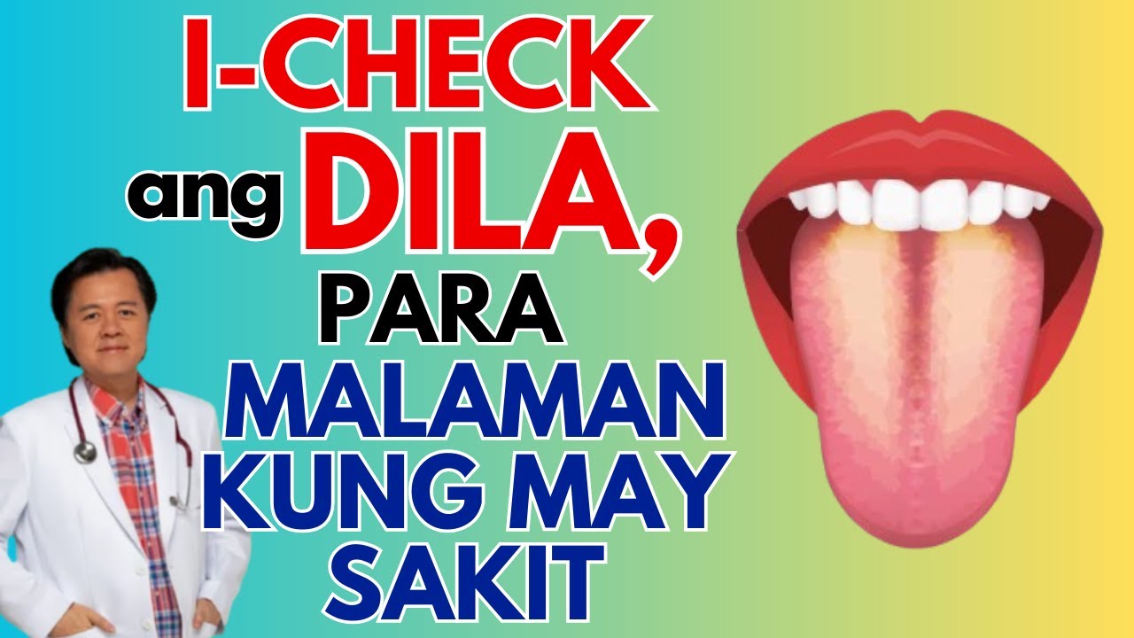I-Check ang Dila, Para Malaman Kung May Sakit. - By Doc Willie Ong