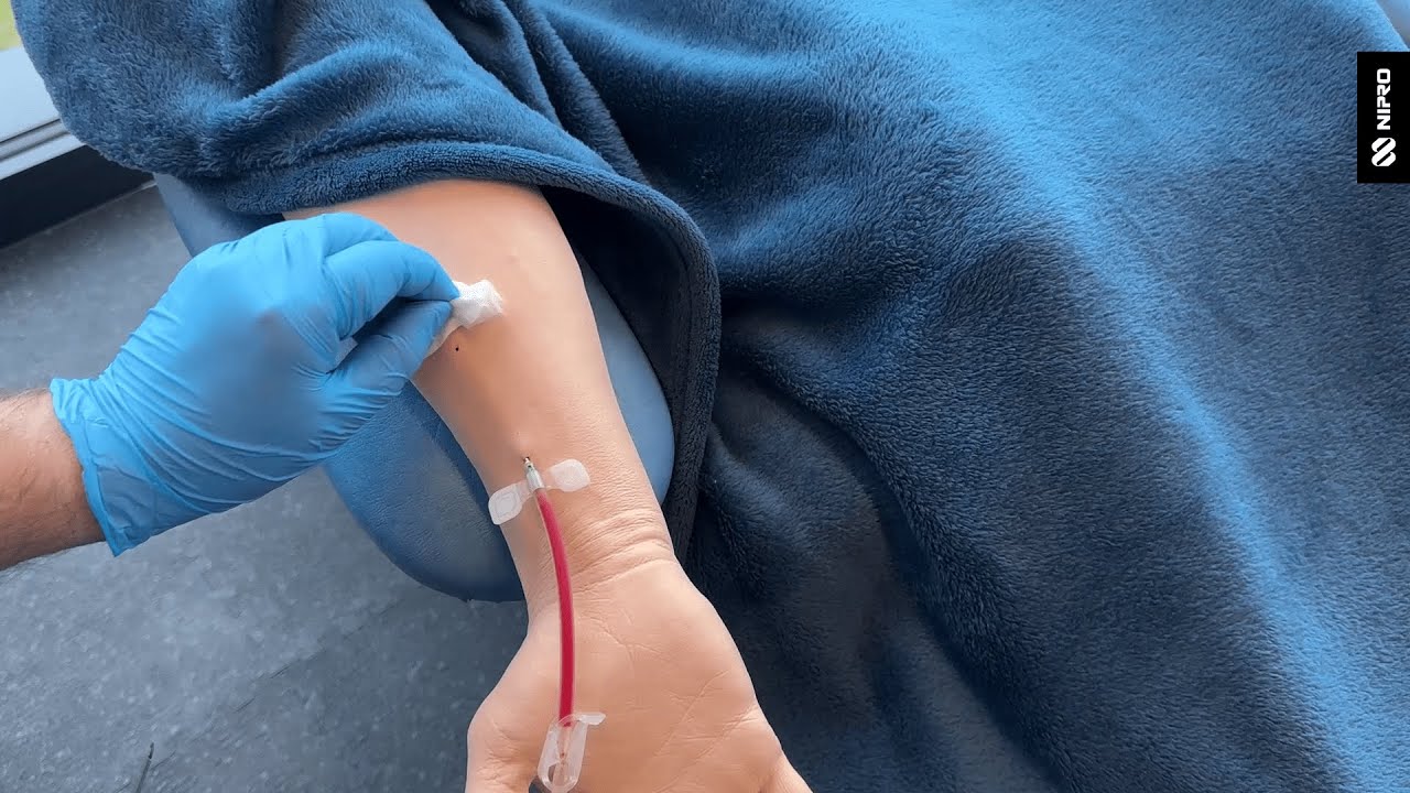 iMEP Tips & Tricks 31: Buttonhole Technique Preventing Infection During Cannulation