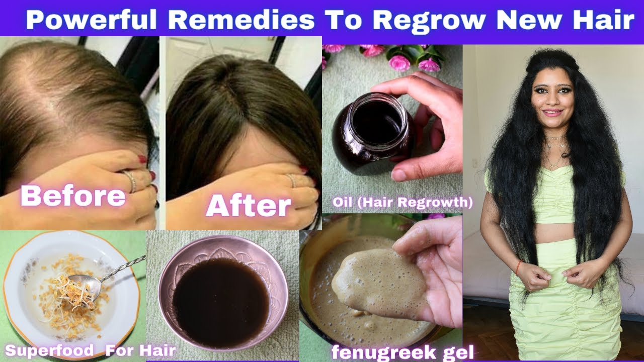 Regrow Your Lost Hair Within 30 Days With This miracle Gel, Oil and Superfood and make hair thick
