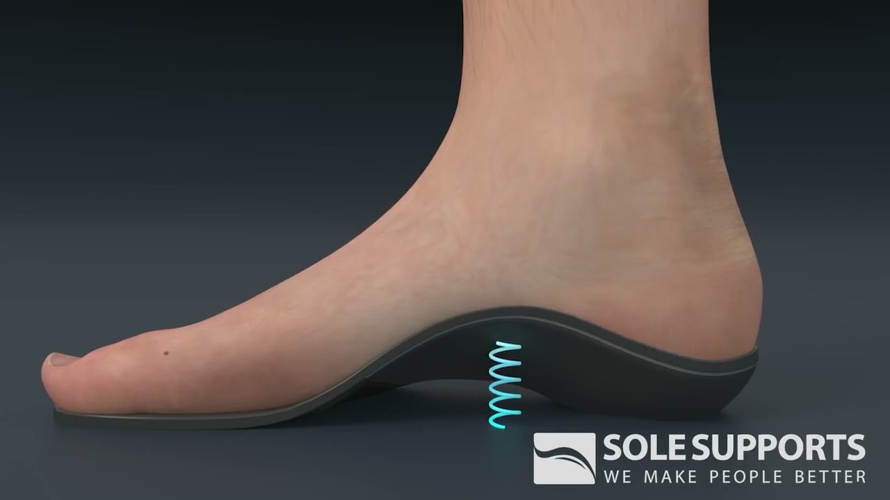 How Do I Know I Need Foot Orthotics? — Sole Supports Custom Orthotics