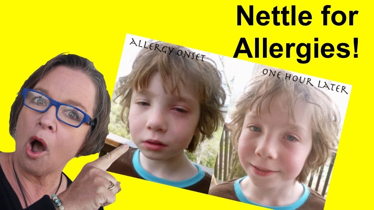 ✅ Nettle for Allergies: A Simple Nettle Tea Remedy for Allergies