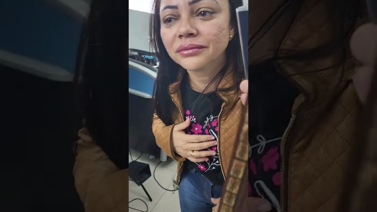 Remoção de Micropigmentação nos Lábios, tentou em outra clínica que não deu certo e veio na HellTato