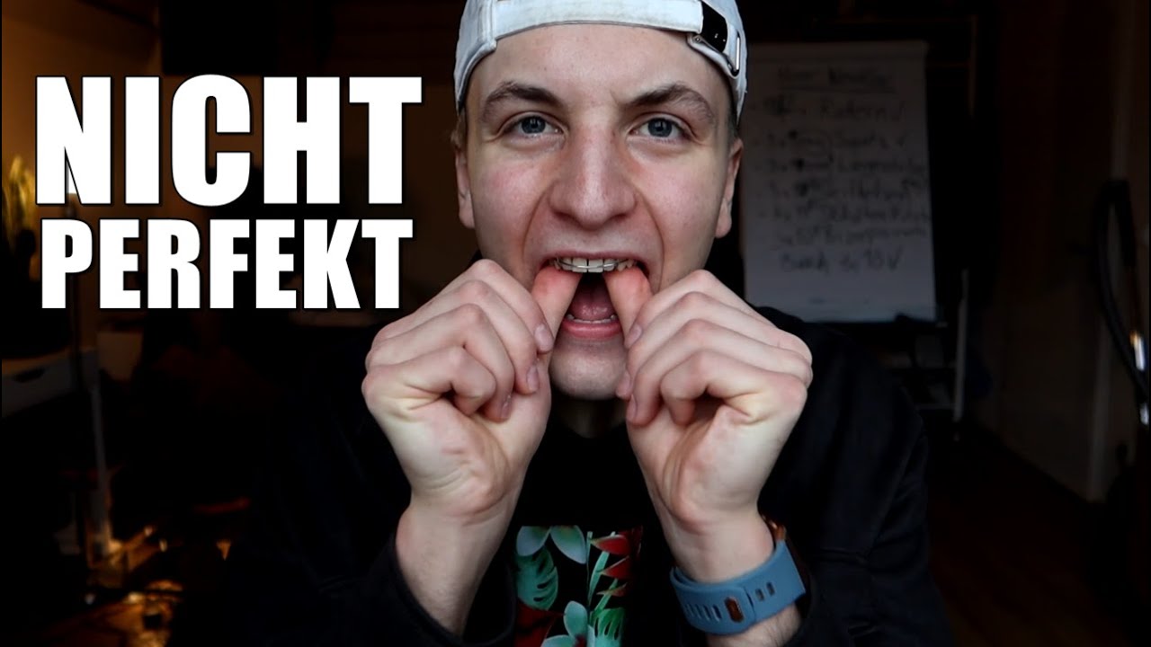 LOSE ZAHNSPANGE nach KieferOP/Bimax/GNE | UPDATE