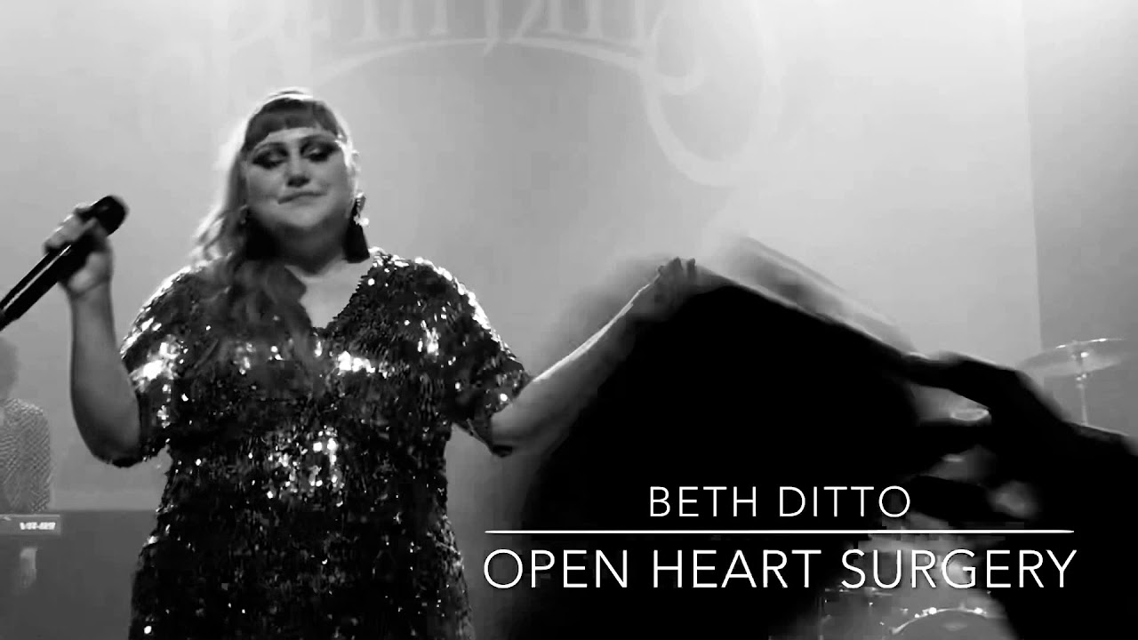Beth Ditto Open Heart Surgery
