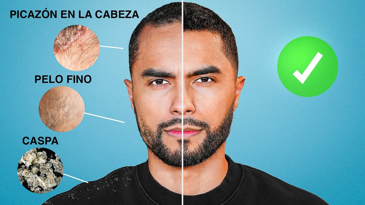 ¡Errores al lavar el cabello que arruinarán tu cabello! | Cómo lavarse el cabello correctamente