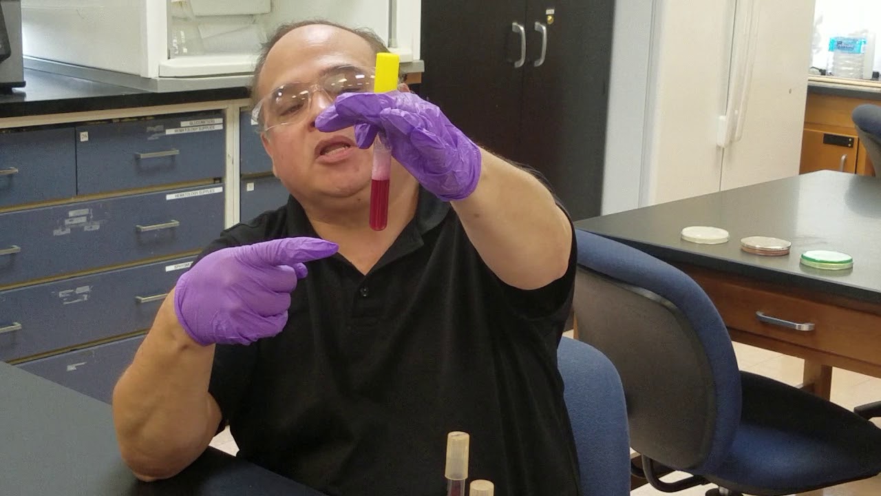 Nitrate Reduction Test