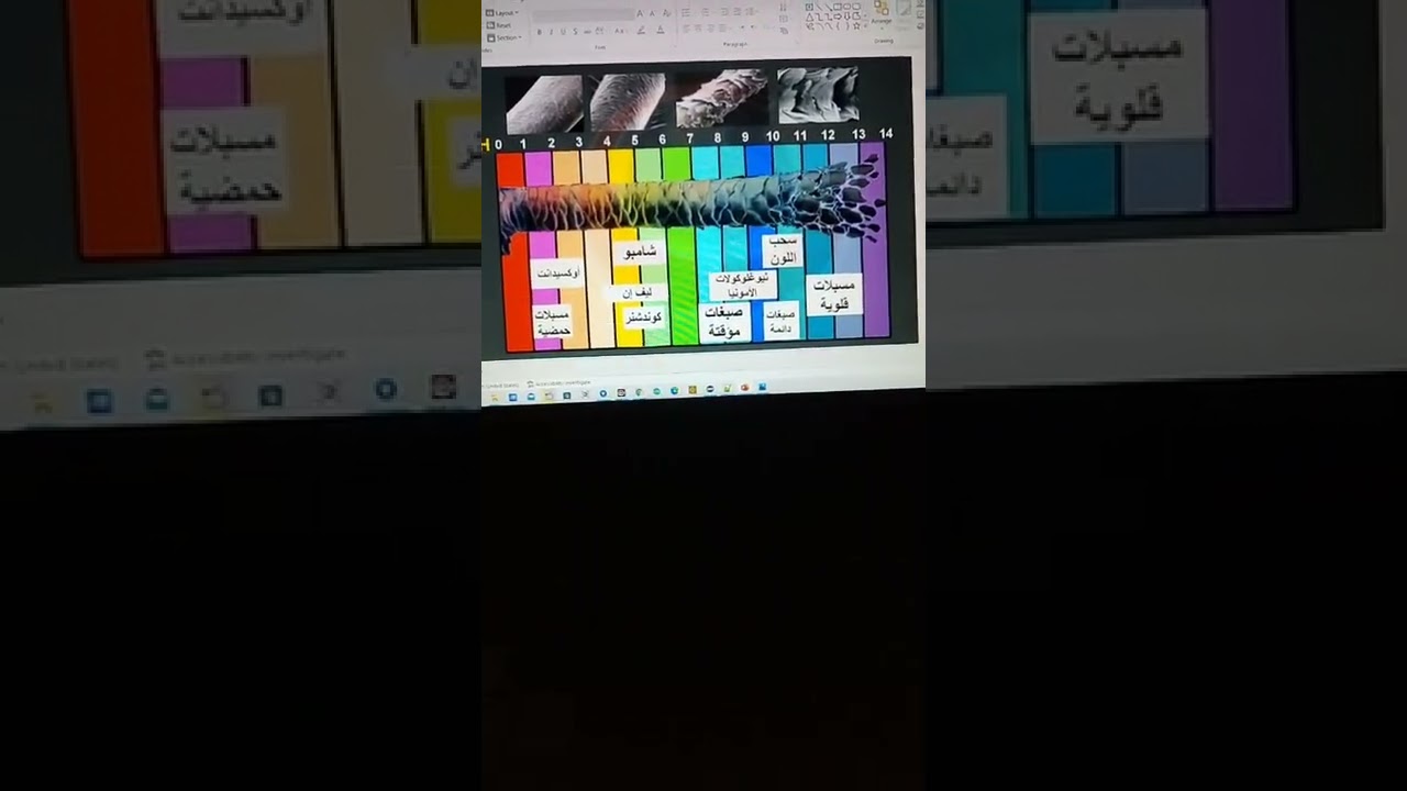 Trichology part 3 by Dr Walaa El Sharkawy