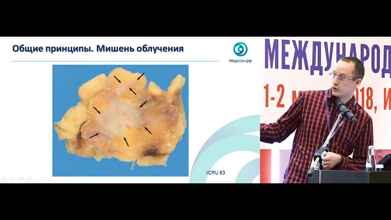 Радиобиологические основы лучевой терапии рака легкого