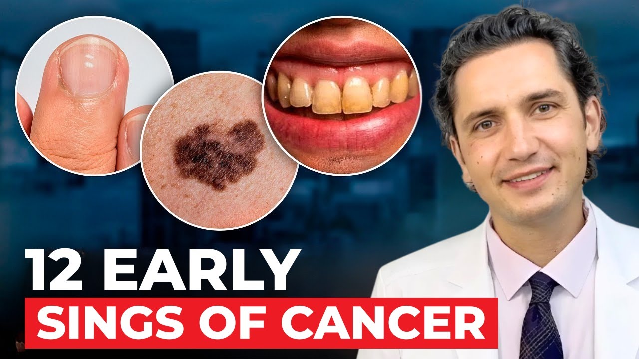 12 Early Signs of Cancer People Ignore (Until It’s Too Late)