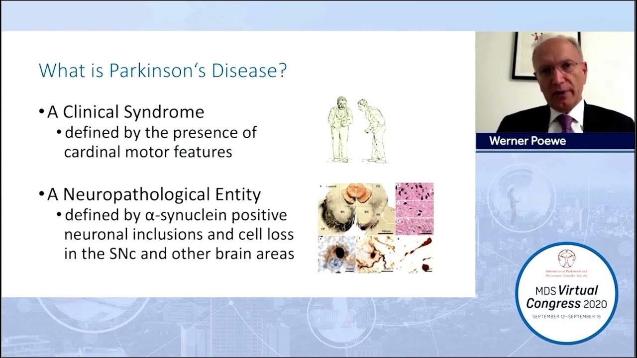 Diagnosing Parkinson’s Disease: From the Street to the Bench - Werner Poewe