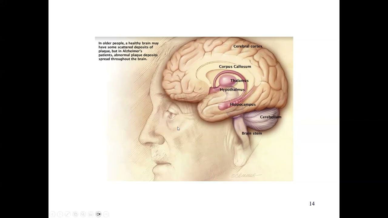 Advances in Alzheimer's Diagnosis and Treatment