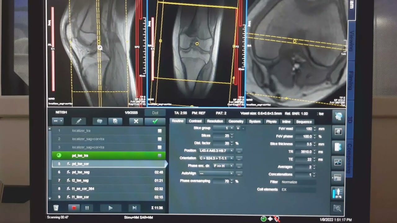 MRI KNEE JOINT PROTOCOL AND PLANNING