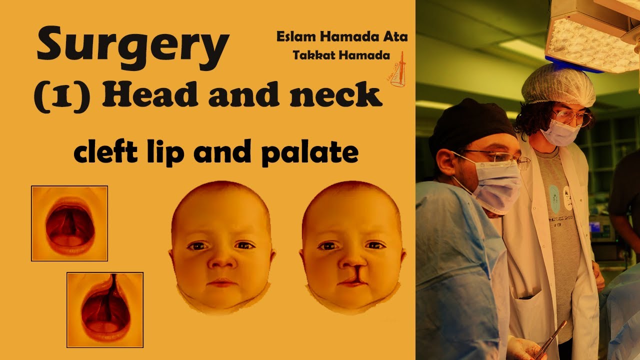 (1) Surgery | Head and neck (Plastic) | cleft lip and palate