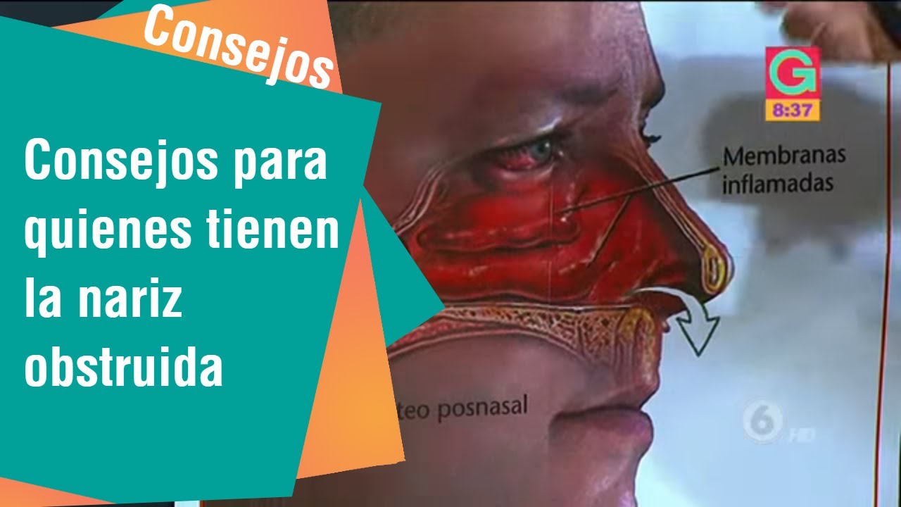 Consejos para quienes tienen la nariz obstruida | Consejos para usted