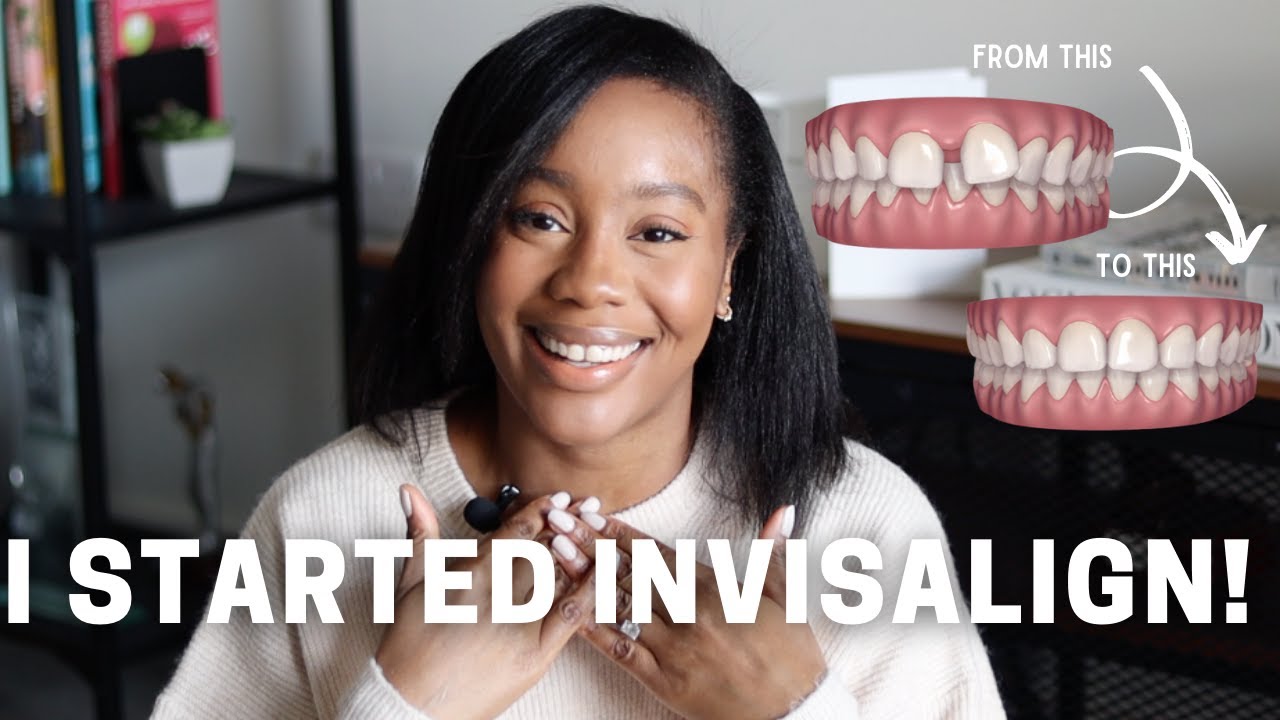 ПУТЬ INVISALIGN №1 | Как закрыть пробел, выбор стоматолога, стоимость, боль и то, чего я не ожидала