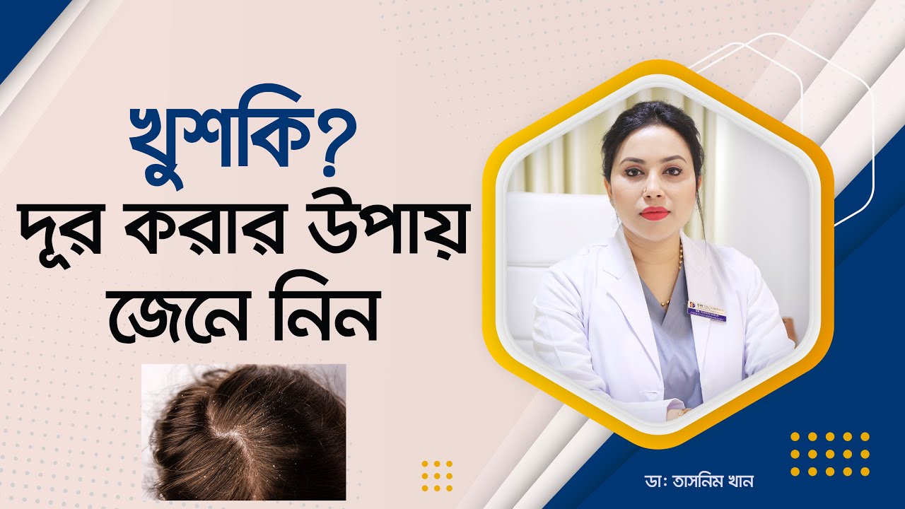 খুশকি দূর করতে করণীয় কি? What to do to get rid of dandruff?