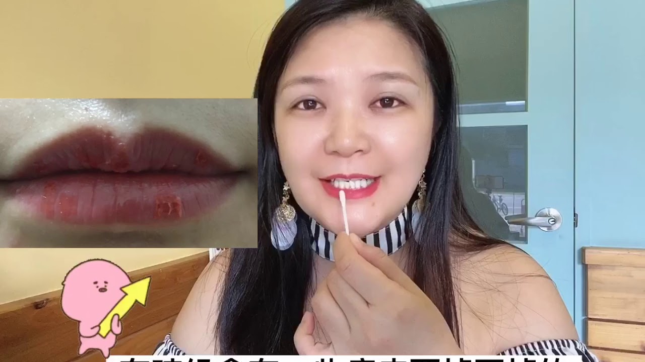 24小時都擁有好氣色｜水嫩嘟嘟唇做完後的術後保養須知