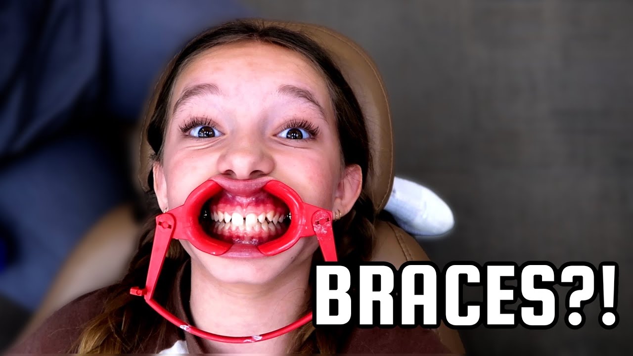 LONDON GOT BRACES & SURPRISED EVERYONE!