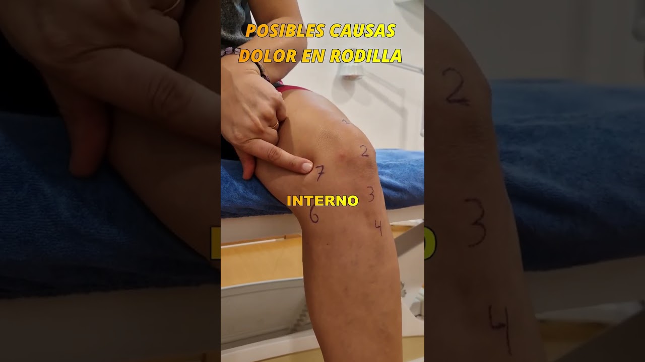 🔷Causas de dolor de RODILLA #fisioterapia #dolor#rodilla#
