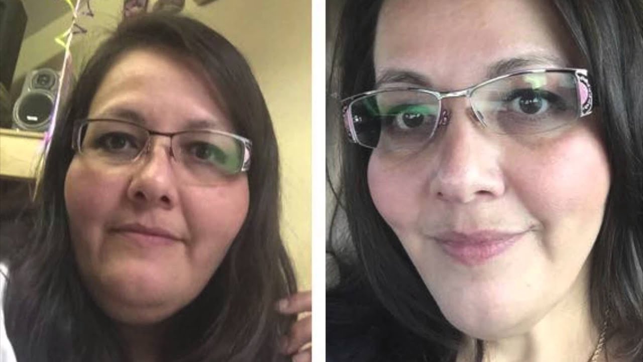 Face to Face Friday | Weight Loss Before & After Pictures | Gastric Sleeve Surgery