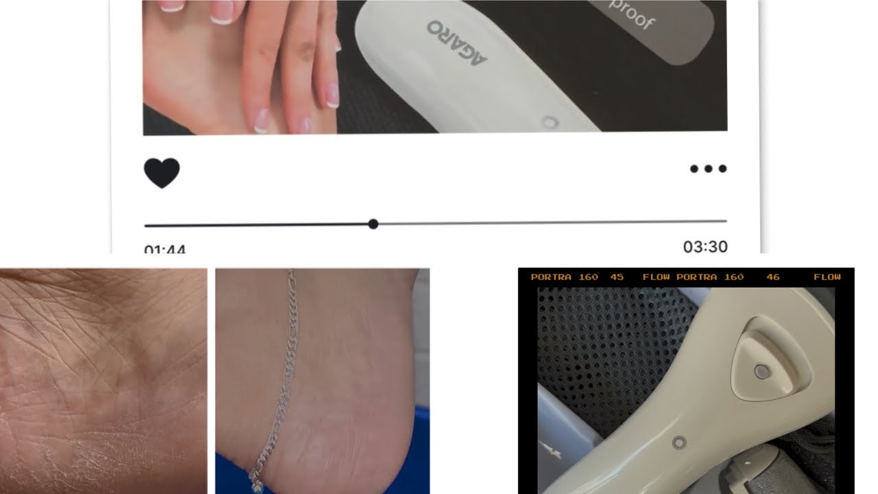 This One Tool Changed My Foot Care Routine| Every Step Deserves Comfort| Calm Steps, Calm Life