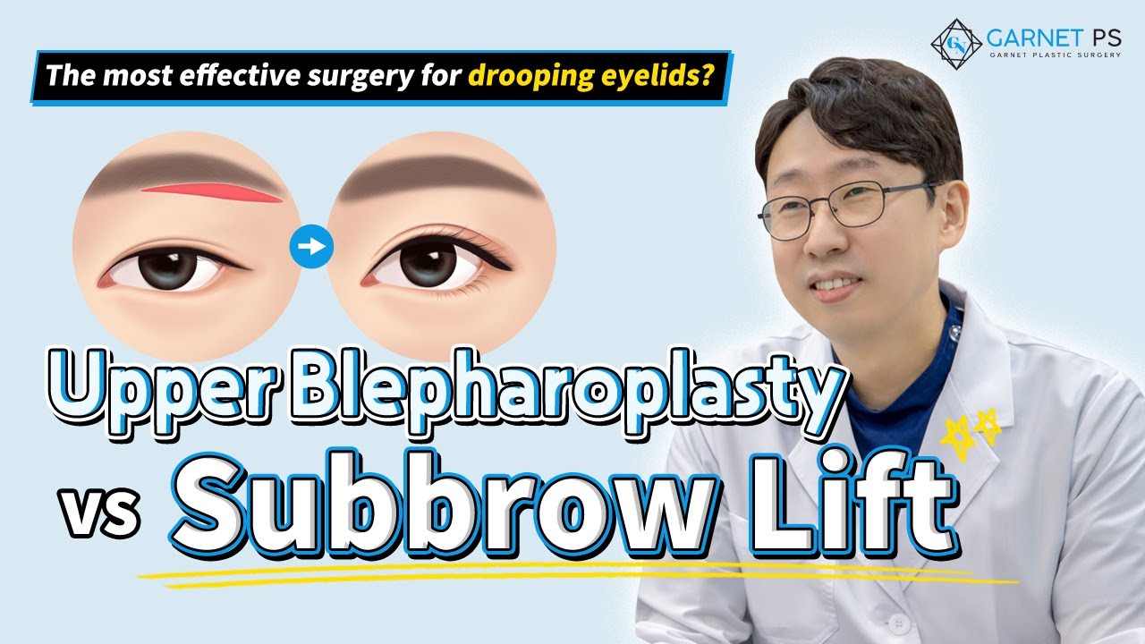 【Subbrow lift】 VS 【Upper Blepharoplasty】👉🏻 Which is the most effective surgery for drooping eyelids?