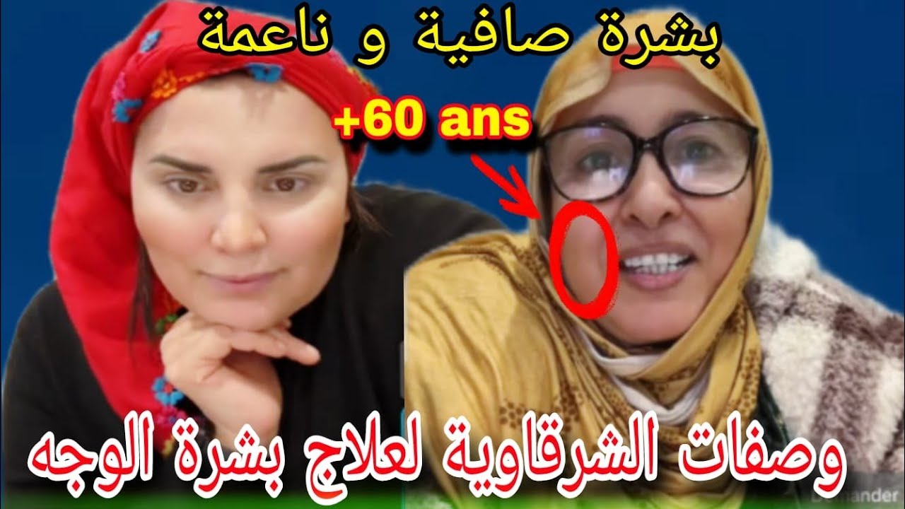نصيحة الدريات حيدو عليكم الحسد ⛔️  إسهل عليكم الله خرجات على وجها 😞 شفو الوصفة ليعطاتها الشرقاوية 👌🏽