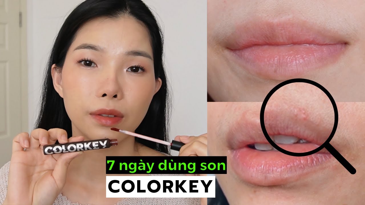7 ngày dùng thử Colorkey, bị lên mụn và...?