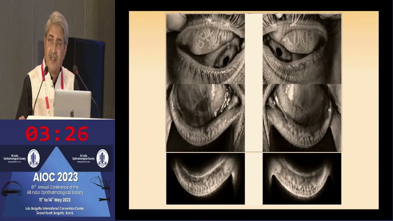 AIOC2023 IC390 topic Dr  SAMAR KUMAR BASAK Tear Film Diagnostics and  Lipiview and LipiFlow!